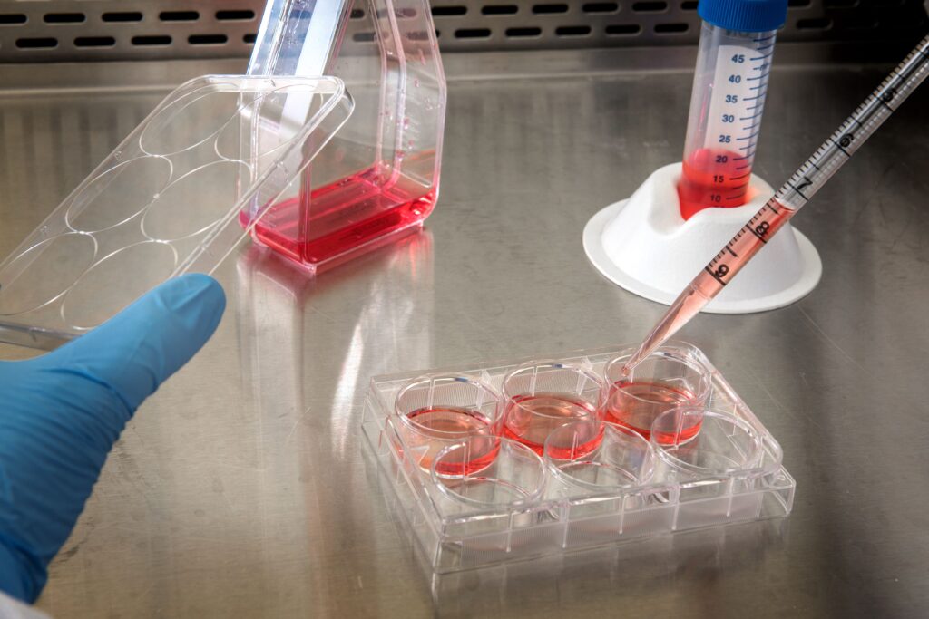 CAR T Cell Therapy